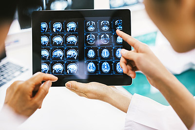 Sacramento brain injury attorney